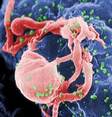 Veränderte Stammzellen attackieren HIV